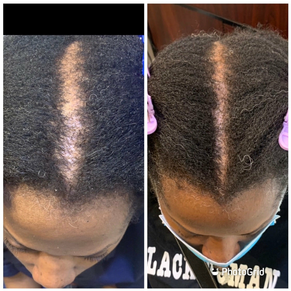 Growth Cleansing & Conditioning Team - Natural or Advanced