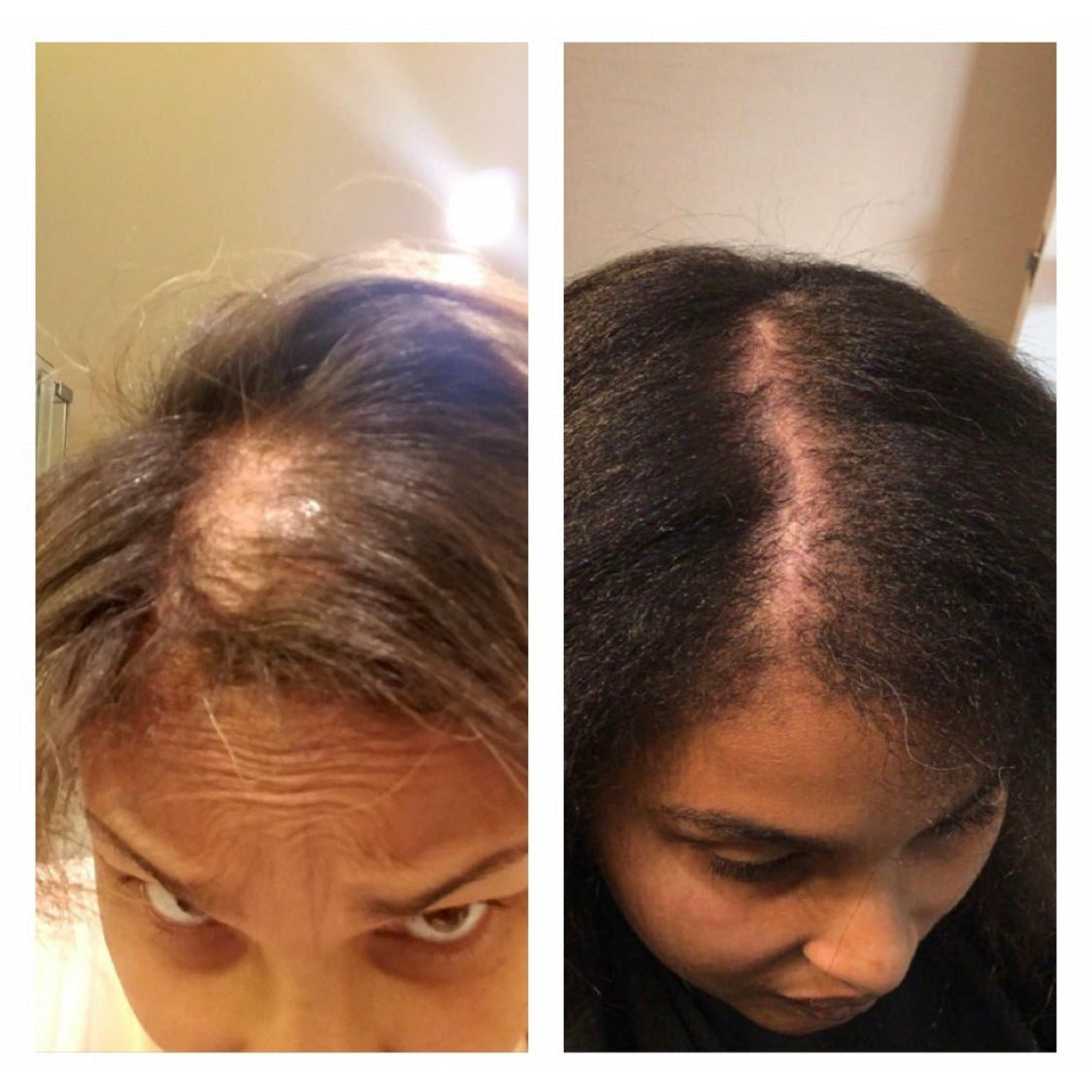 Natural Hair Growth System | 3-Month Supply