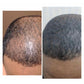 30 day Advanced Hair Growth+ Supplements