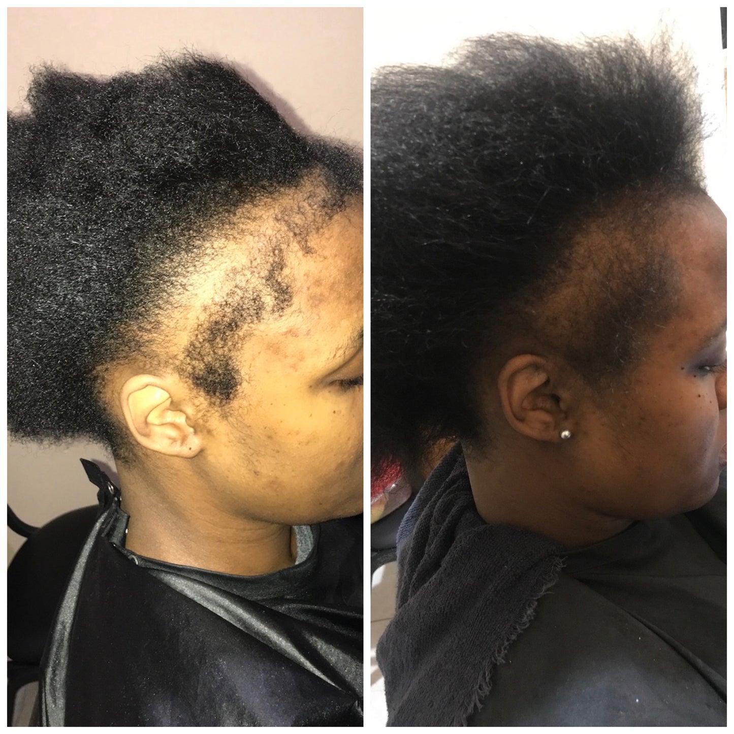 Natural Hair Growth System | 3-Month Supply
