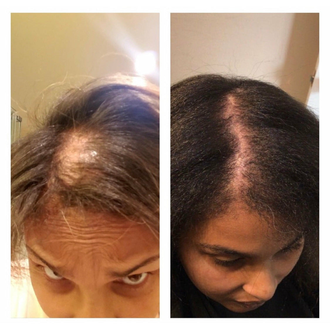 natural hair growth before and after